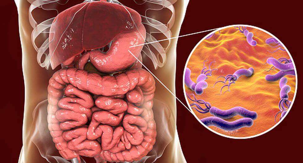 Helicobacter Pylori sintomas y tratamientos