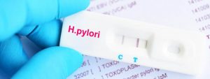 Helicobacter Pylori sintomas y tratamientos